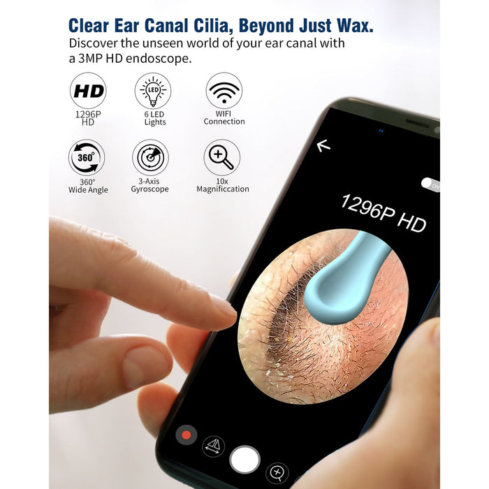 KEKOY Earwax Cleaner Kit, Ear Wax Removal Tool with 1296P HD Camera and 6 LED Lights, Ear Cleaner with 10 Ear Pick, Upgrade Ear Wax Removal Tool for iOS and Android, Gray