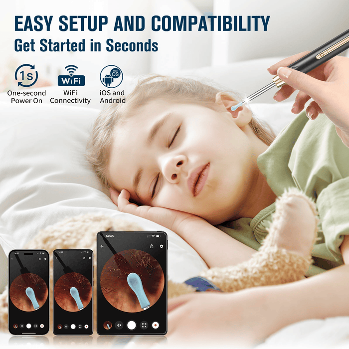 KEKOY Ear Cleaner with Camera, 1296P Ear Scope, Otoscope with 6 LED Light for Earwax Cleaning, Ear Wax Removal with 12 Pieces Accessories, Ear Wax Cleaner Kit for iPhone, iPad, Android, Green